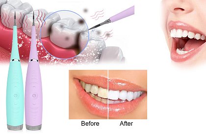 Ultrazvukový čistič zubov