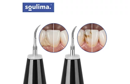 Ultrazvukový odstraňovač zubného kameňa + príslušenstvo